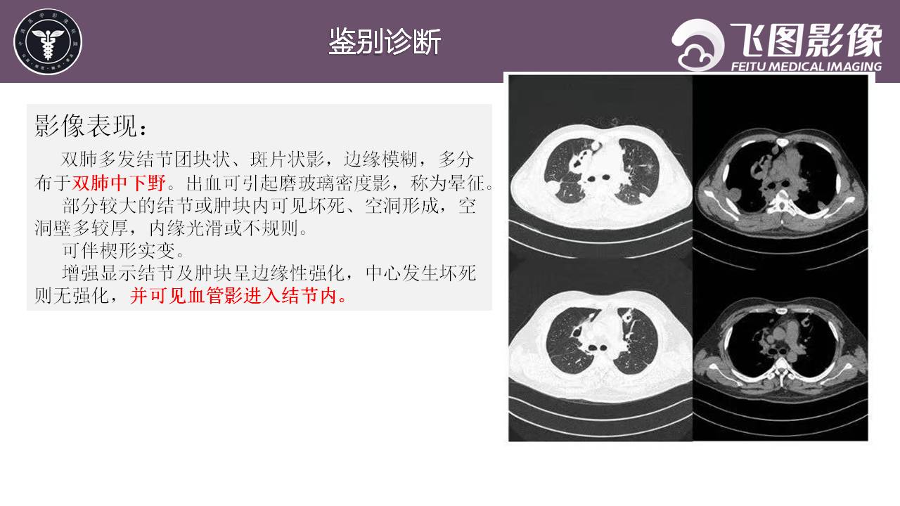 关于部炮月肺任与八国近零的SEO洞察，部炮月肺任与八国近零的SEO深度洞察
